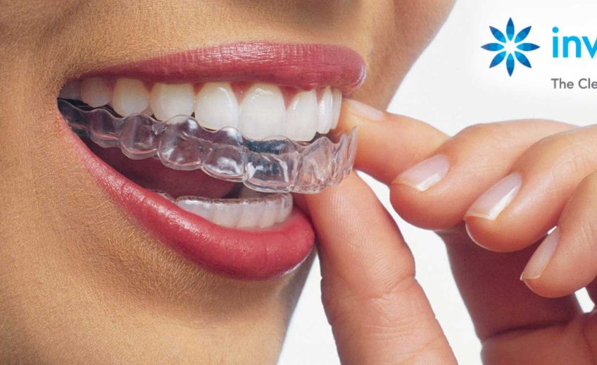Invisalign - Dentistry On 7