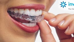 Invisalign-dentistry-on-7-service-848x518
